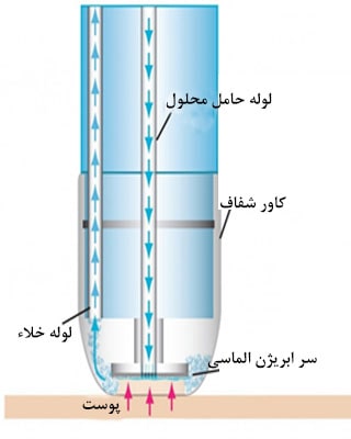هیدرودرمی یا آبرسانی به پوست شیوه کار دستگاه آب رسان